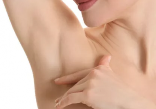 Underarms